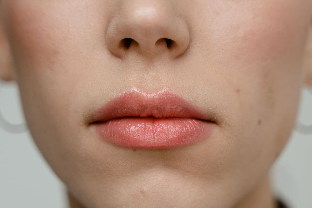 Labbra irritate: le alternative al burrocacao