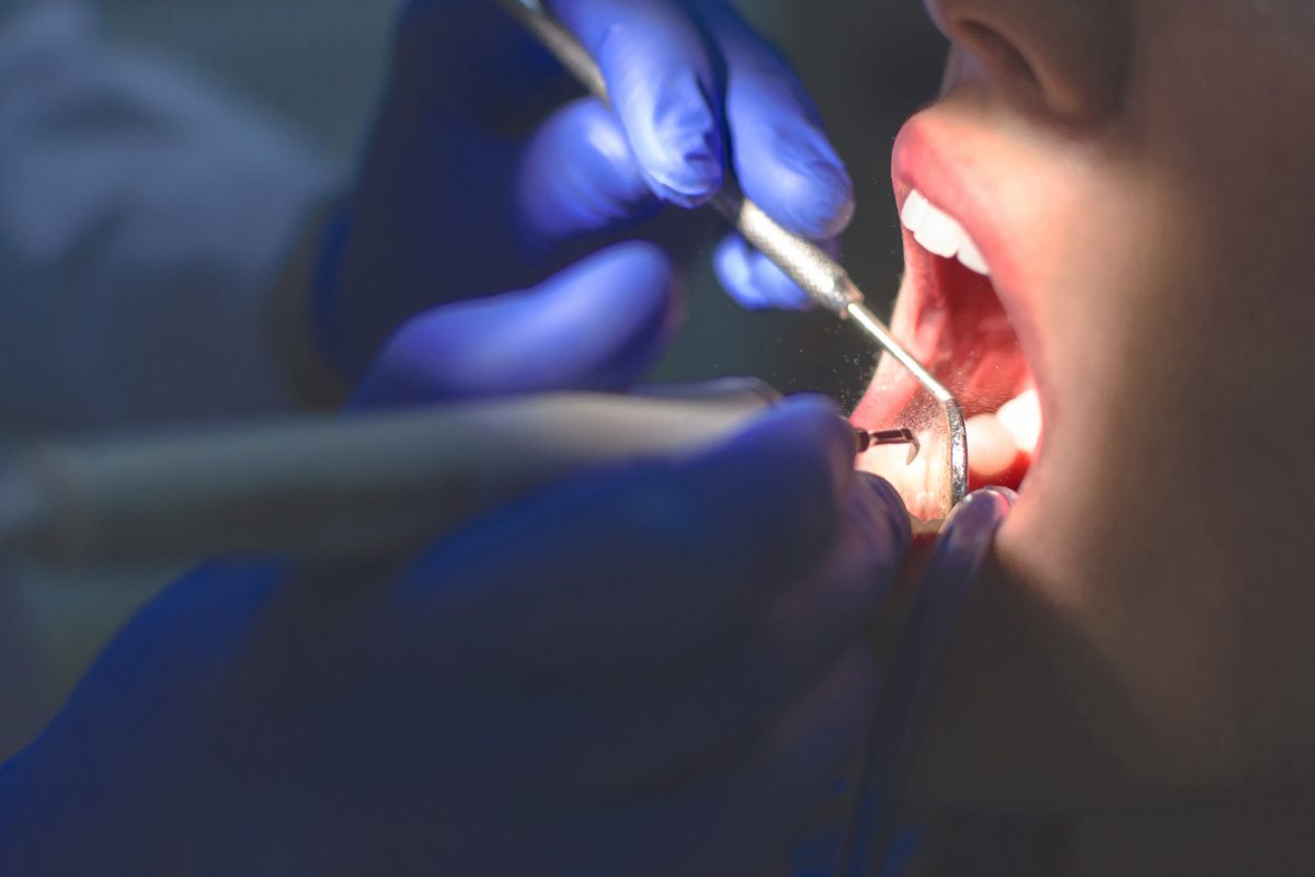 c è bisogno di pulire bene la gola… il dentista nascondeva un terribile segreto da Cityrumors.it c è bisogno di pulire bene la gola… il dentista nascondeva un terribile segreto