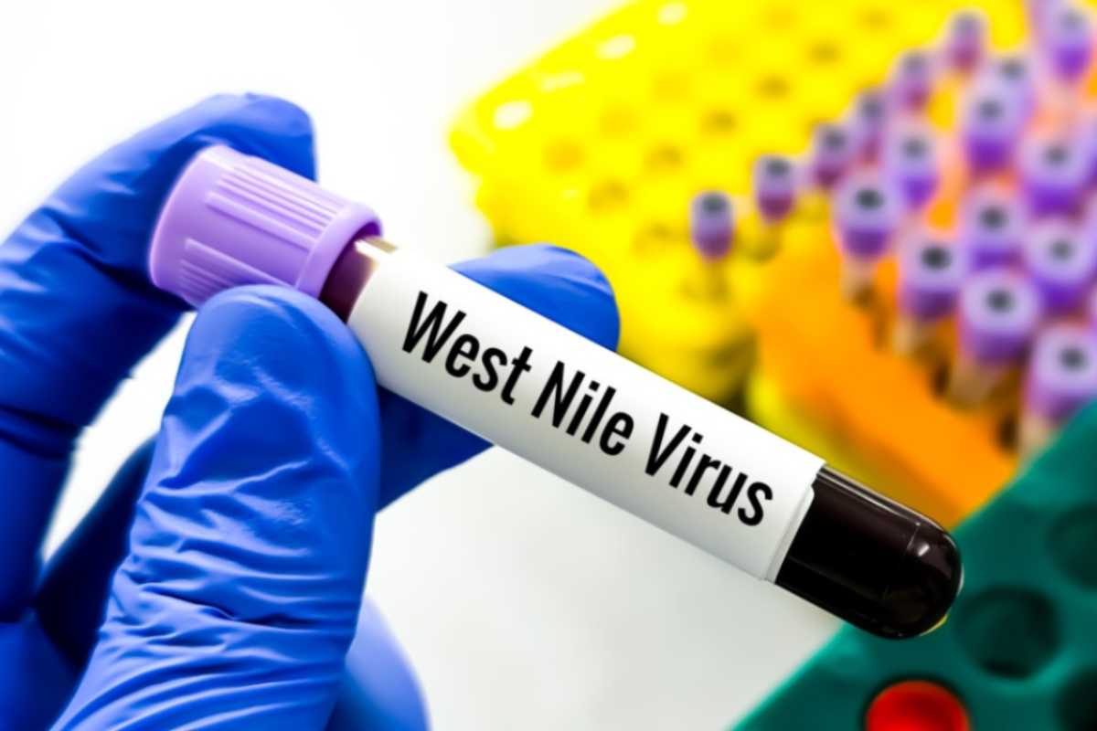 Virus