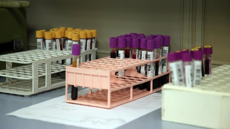 Alcuni campioni all'interno di un laboratorio analisi